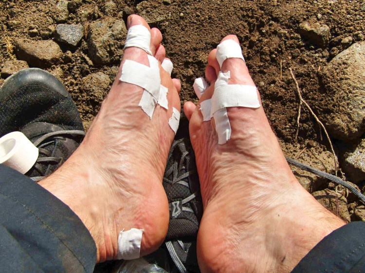 Ouch - the feet were hurting